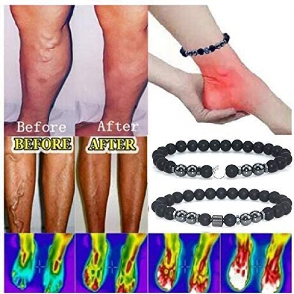 Anti-Swelling Black Obsidian Anklet Adjustable Magnet Weight Loss Bracelet Feng Shui Black Obsidian Anklet for Foot Pain Relief (5pcs)